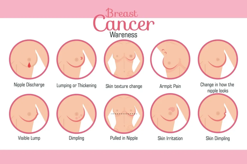 Breast Biopsy, Stereotactic Breast Biopsy,Biopsy